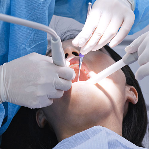 A woman undergoing wisdom tooth extraction at Glenn Smile Center.