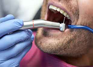 The image illustrates the Glenn Smile Center staff skillfully administering excellent dental fillings.