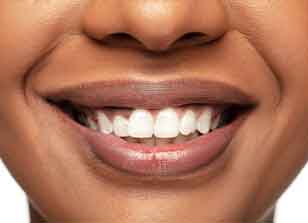 All smiles following preventive dental work at Glenn Smile Center.