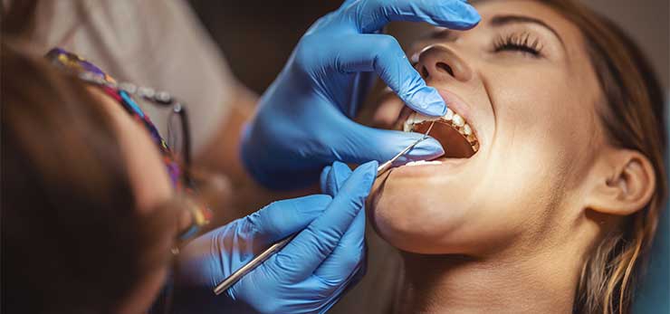 Precision in Glenn Smile Center's dental bonding procedures stands out.