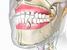 The image reveals a 3D mockup that Glenn Smile Center employs to detail their dental services.