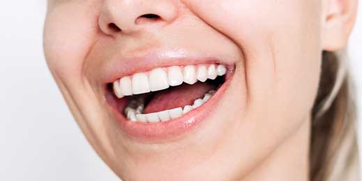 Young woman elated by her best teeth whitening results at Glenn Smile Center.