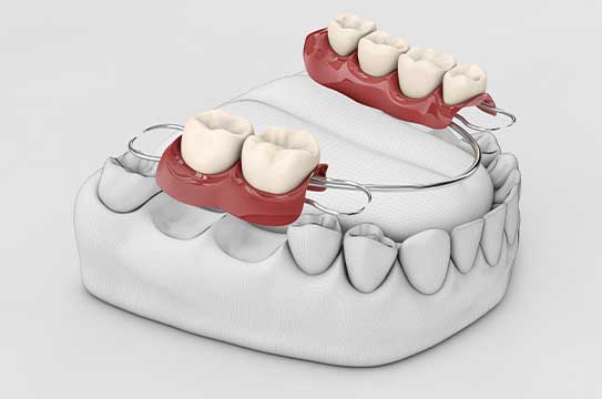 From an objective perspective, the 3D model mockups at Glenn Smile Center innovatively represent denture service excellence.